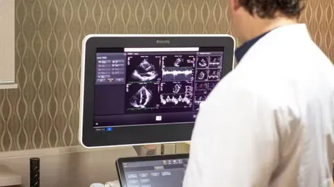 Ecocardiograma Transtorácico (Ecodopplercardiograma)